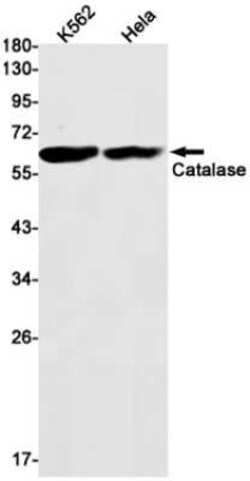Catalase Rabbit anti-Human, Clone: S05-5D9, Novus Biologicals 100 &mu;g | Buy Online | Bio-Techne | Fisher Scientific