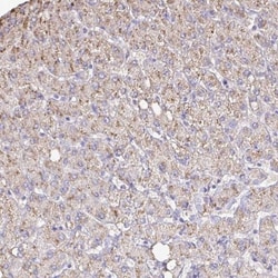 Catalase Antibody, Novus Biologicals 0.1mL; Unlabeled:Antibodies, Polyclonal