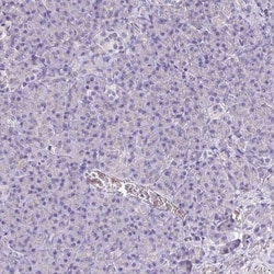 Catalase Antibody, Novus Biologicals 0.1mL; Unlabeled:Antibodies, Polyclonal