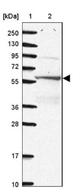 Catalase Antibody, Novus Biologicals 0.1mL; Unlabeled:Antibodies, Polyclonal