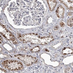 Cathepsin A/Lysosomal Carboxypeptidase A Antibody, Novus Biologicals 0.1mL;