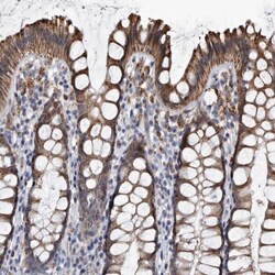 Cathepsin A/Lysosomal Carboxypeptidase A Antibody, Novus Biologicals 0.1mL;