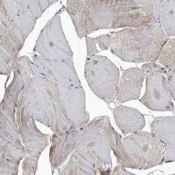 Cathepsin A/Lysosomal Carboxypeptidase A Antibody, Novus Biologicals 0.1mL;