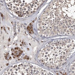 Cathepsin A/Lysosomal Carboxypeptidase A Antibody, Novus Biologicals 0.1mL;
