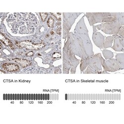 Cathepsin A/Lysosomal Carboxypeptidase A Antibody, Novus Biologicals 0.1mL;