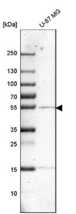 Cathepsin A/Lysosomal Carboxypeptidase A Antibody, Novus Biologicals 0.1mL;