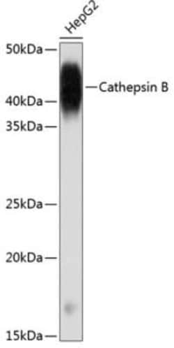 Cathepsin B Rabbit anti-Human, Clone: 6I5D7, Novus Biologicals 100 &mu;g | Buy Online | Novus Biologicals | Fisher Scientific