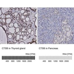 Cathepsin B Rabbit anti-Human, Polyclonal, Novus Biologicals 100 &mu;g;