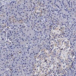 Cathepsin B Rabbit anti-Human, Polyclonal, Novus Biologicals 100 &mu;g;