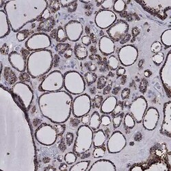 Cathepsin B Rabbit anti-Human, Polyclonal, Novus Biologicals 100 &mu;g;
