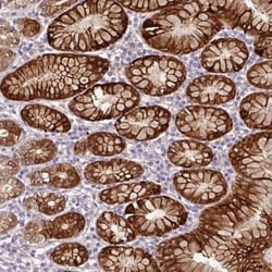 Cathepsin E Antibody, Novus Biologicals 0.1mL; Unlabeled:Antibodies, Polyclonal