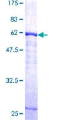 Novus Biologicals Recombinant Human Cathepsin K GST (N-Term) Protein 2 &mu;g | Buy Online | Novus Biologicals&trade; | Fisher Scientific