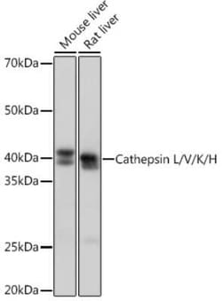 Cathepsin L/V/K/H Rabbit anti-Human, Mouse, Rat, Clone: 2Q10F10, Novus
