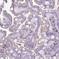 Cathepsin X/Z/P Antibody, Novus Biologicals:Antibodies:Primary Antibodies