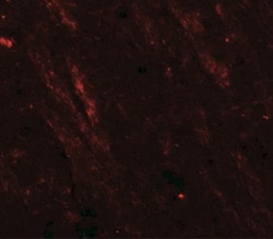 Cav3.2 Antibody - BSA Free, Novus Biologicals:Antibodies:Primary Antibodies