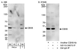 Cbx8 Antibody, Novus Biologicals 100 &mu;L | Buy Online | Novus Biologicals | Fisher Scientific