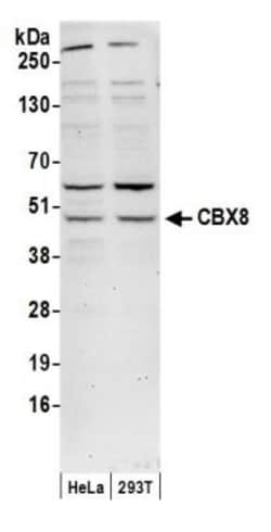 Cbx8 Antibody, Novus Biologicals 100 &mu;L | Buy Online | Novus Biologicals | Fisher Scientific
