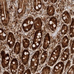 Cdc14A Antibody, Novus Biologicals:Antibodies:Primary Antibodies