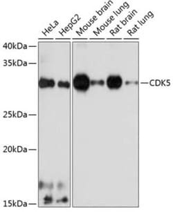 Cdk5 Rabbit anti-Human, Mouse, Rat, Clone: 7C8T10, Novus Biologicals 100