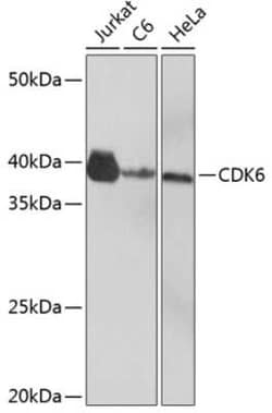Cdk6 Rabbit anti-Human, Rat, Clone: 0O6X7, Novus Biologicals 20 &mu;g | Buy Online | Novus Biologicals | Fisher Scientific