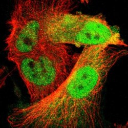 Cdk6 Antibody, Novus Biologicals:Antibodies:Primary Antibodies