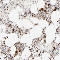 Cdk6 Antibody, Novus Biologicals:Antibodies:Primary Antibodies
