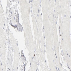 Cdk6 Antibody, Novus Biologicals:Antibodies:Primary Antibodies
