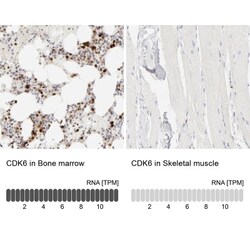 Cdk6 Antibody, Novus Biologicals:Antibodies:Primary Antibodies