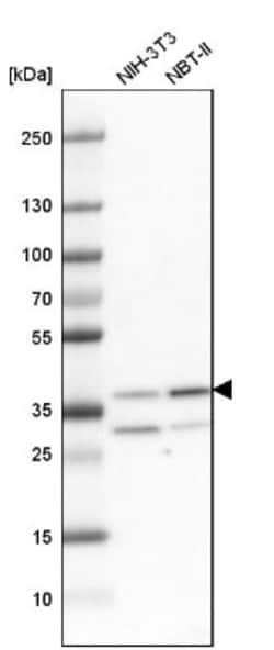Cdk6 Antibody, Novus Biologicals:Antibodies:Primary Antibodies