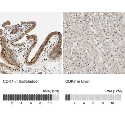 TWEAK R/TNFRSF12 Antibody, Novus Biologicals:Antibodies:Primary Antibodies
