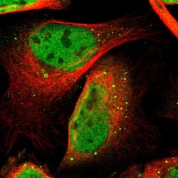 TSPYL6 Antibody, Novus Biologicals:Antibodies:Primary Antibodies
