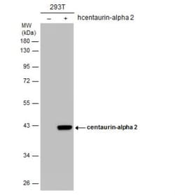 Centaurin alpha 2 Antibody, Novus Biologicals 0.1mL; Unlabeled:Antibodies,