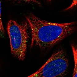 Centaurin beta 2 Antibody, Novus Biologicals 0.1mL; Unlabeled:Antibodies,