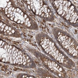 Centaurin beta 2 Antibody, Novus Biologicals 0.1mL; Unlabeled:Antibodies,