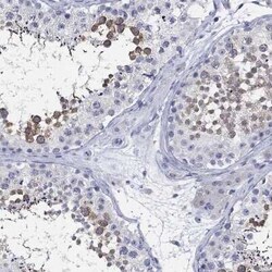 Centrin 1 Rabbit anti-Human, Polyclonal, Novus Biologicals:Antibodies:Primary