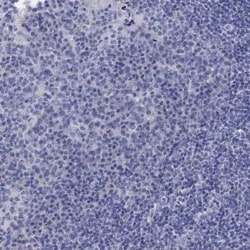 Centrin 1 Rabbit anti-Human, Polyclonal, Novus Biologicals:Antibodies:Primary
