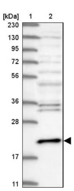 Centrin 3 Antibody, Novus Biologicals:Antibodies:Primary Antibodies