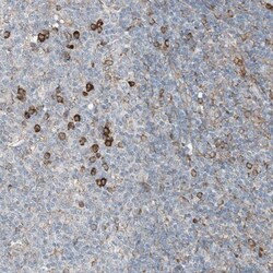 Ceramide Kinase Like Antibody, Novus Biologicals 0.1mL; Unlabeled:Antibodies,