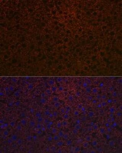 Ceruloplasmin Rabbit anti-Human, Mouse, Rat, Clone: 6C3K9, Novus Biologicals