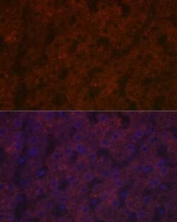 Ceruloplasmin Rabbit anti-Human, Mouse, Rat, Clone: 6C3K9, Novus Biologicals