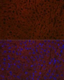 Ceruloplasmin Rabbit anti-Human, Mouse, Rat, Clone: 6C3K9, Novus Biologicals