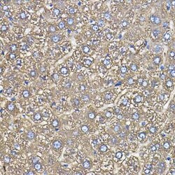 Ceruloplasmin Rabbit anti-Human, Mouse, Rat, Clone: 6C3K9, Novus Biologicals