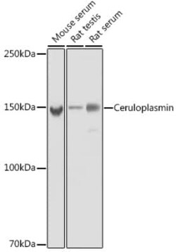 Ceruloplasmin Rabbit anti-Human, Mouse, Rat, Clone: 6C3K9, Novus Biologicals