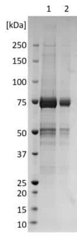 Novus Biologicals Recombinant Virus Chikungunya Virus E2 Fc Protein 0.5 mg | Buy Online | Novus Biologicals | Fisher Scientific