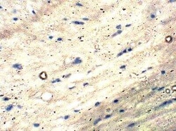 Chimaerin 2 Antibody, Novus Biologicals 100 &mu;g; Unconjugated:Antikörper