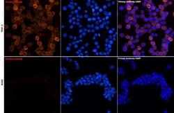 Chitinase 3-like 1 Rabbit anti-Human, Mouse, Clone: 9P1P6, Novus Biologicals