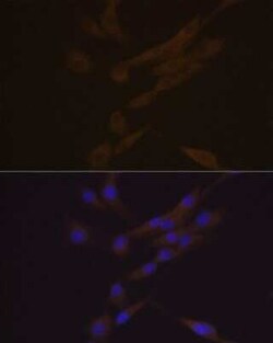 Chitinase 3-like 1 Rabbit anti-Human, Mouse, Clone: 9P1P6, Novus Biologicals