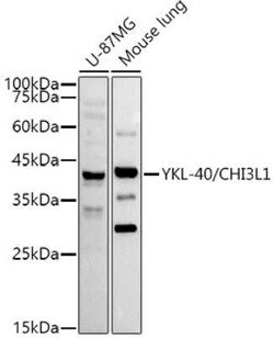 Chitinase 3-like 1 Rabbit anti-Human, Mouse, Clone: 9P1P6, Novus Biologicals