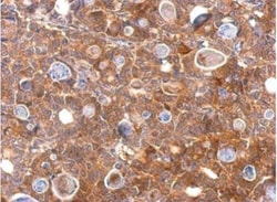 Chitinase 3-like 2 Antibody, Novus Biologicals 0.1mL; Unlabeled:Antibodies,