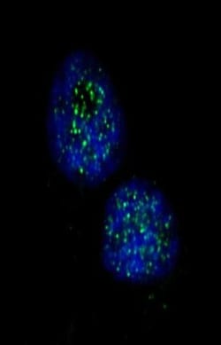 Chk1 Antibody, Novus Biologicals 0.1mg; Unlabeled:Antibodies, Polyclonal